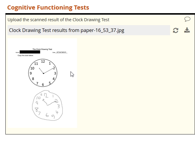 Clock-Drawing-Test